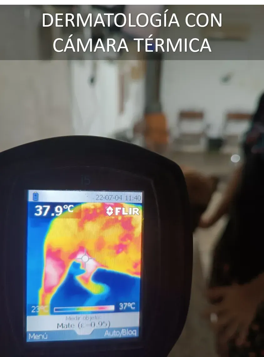 Endoscopios / Camara térmica